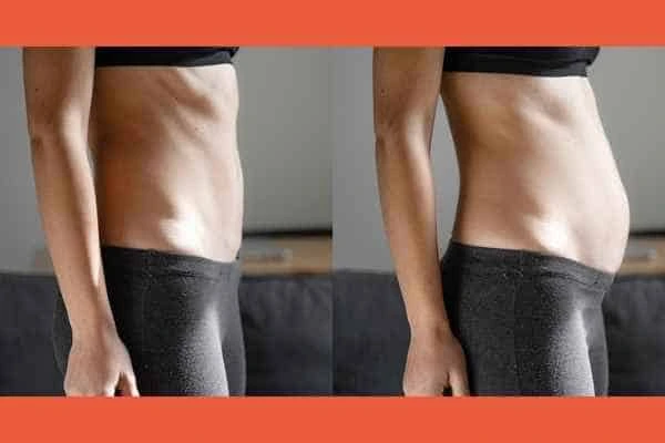 LA-EMS Body Sculpting results Dartford